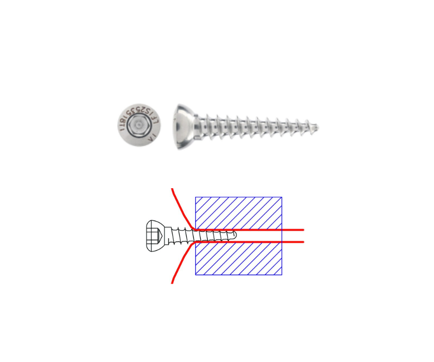 Ligafiba IsoToggle locking skruv