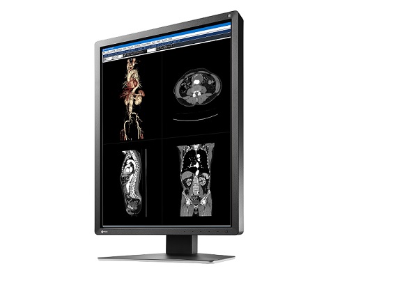 Granskningsmonitor RadiForce MX216-SB