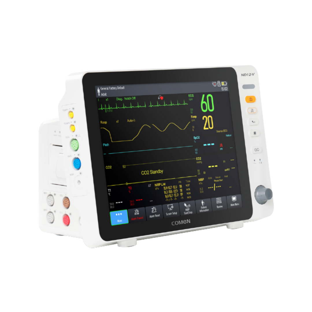 Övervakning, monitorering