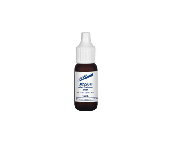 31210-infärgning-urine-sediment-jorvet-scandivet