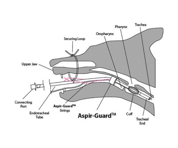 Aspir-Guard ring - Bild 3