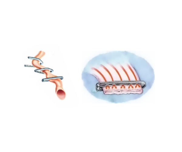 11295-clips-horizon-scandivet