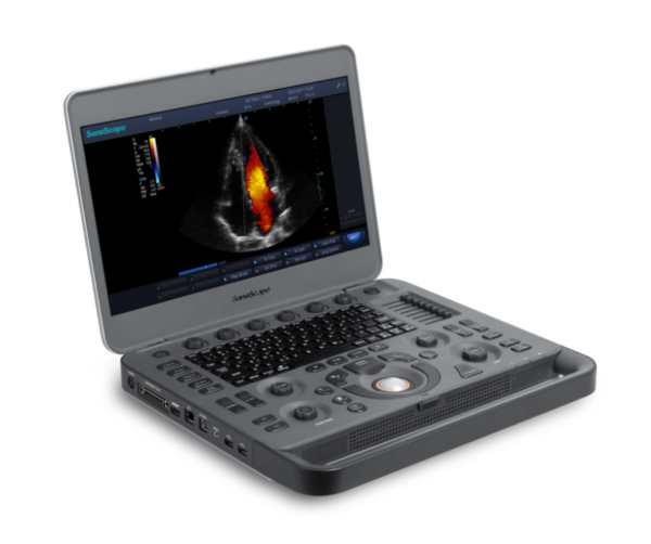 10482050-sonoscape-ultraljud-X3V-scandivet (3)